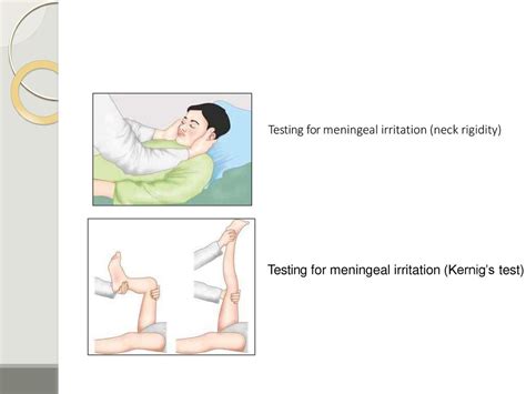 meningeal compression test|csf for meningitis.